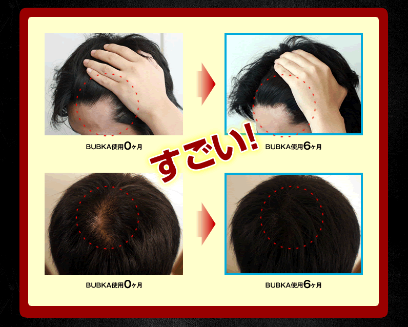 濃密育毛剤BUBKA［ブブカ］の成分